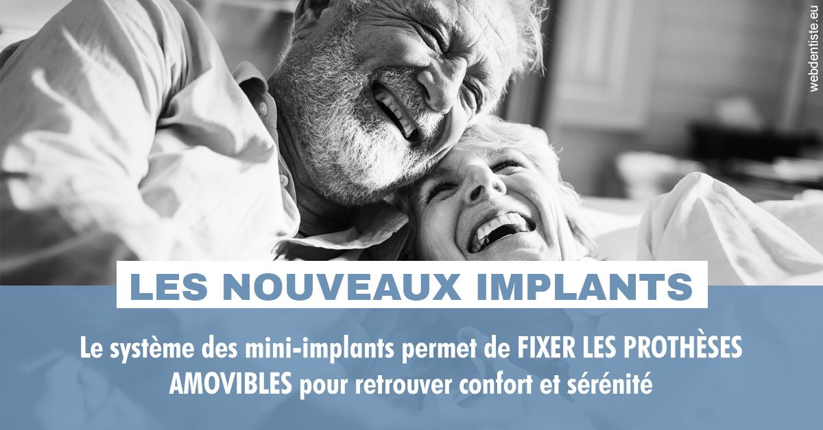 https://dr-andre-boquet-corinne-marie.chirurgiens-dentistes.fr/Les nouveaux implants 2
