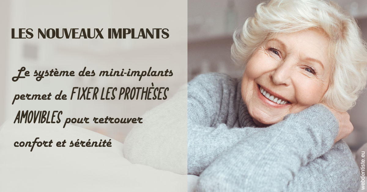 https://dr-andre-boquet-corinne-marie.chirurgiens-dentistes.fr/Les nouveaux implants 1