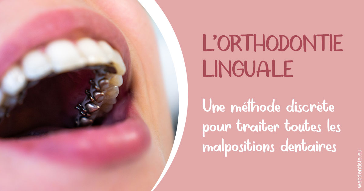 https://dr-andre-boquet-corinne-marie.chirurgiens-dentistes.fr/L'orthodontie linguale 2