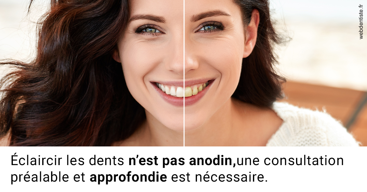 https://dr-andre-boquet-corinne-marie.chirurgiens-dentistes.fr/Le blanchiment 2