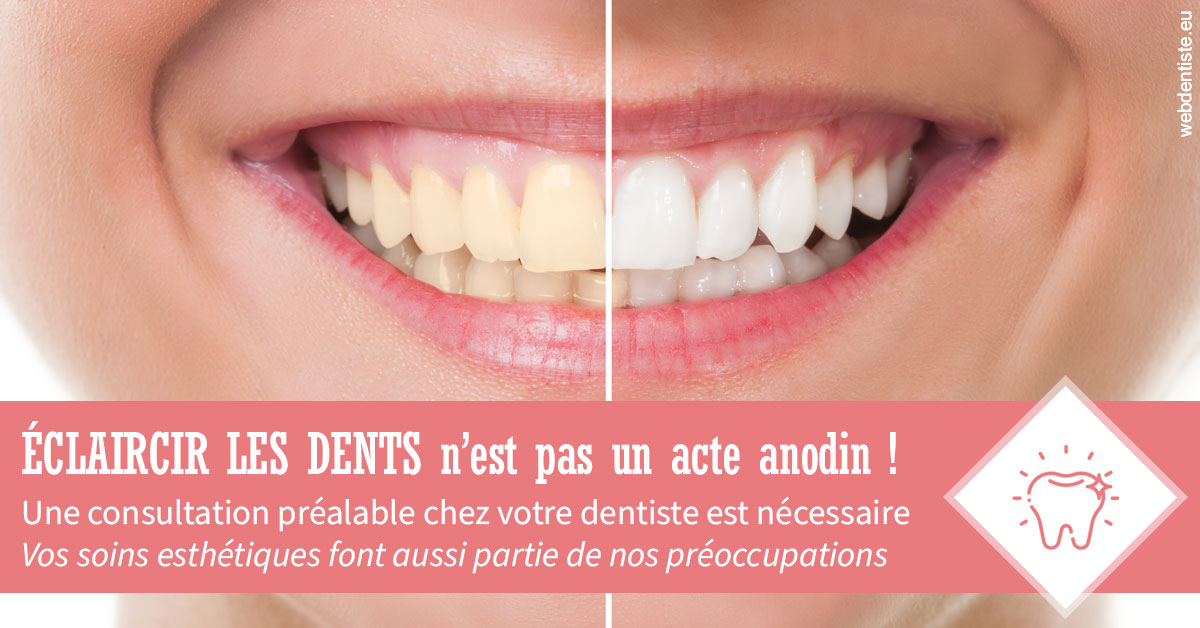 https://dr-andre-boquet-corinne-marie.chirurgiens-dentistes.fr/Eclaircir les dents 1