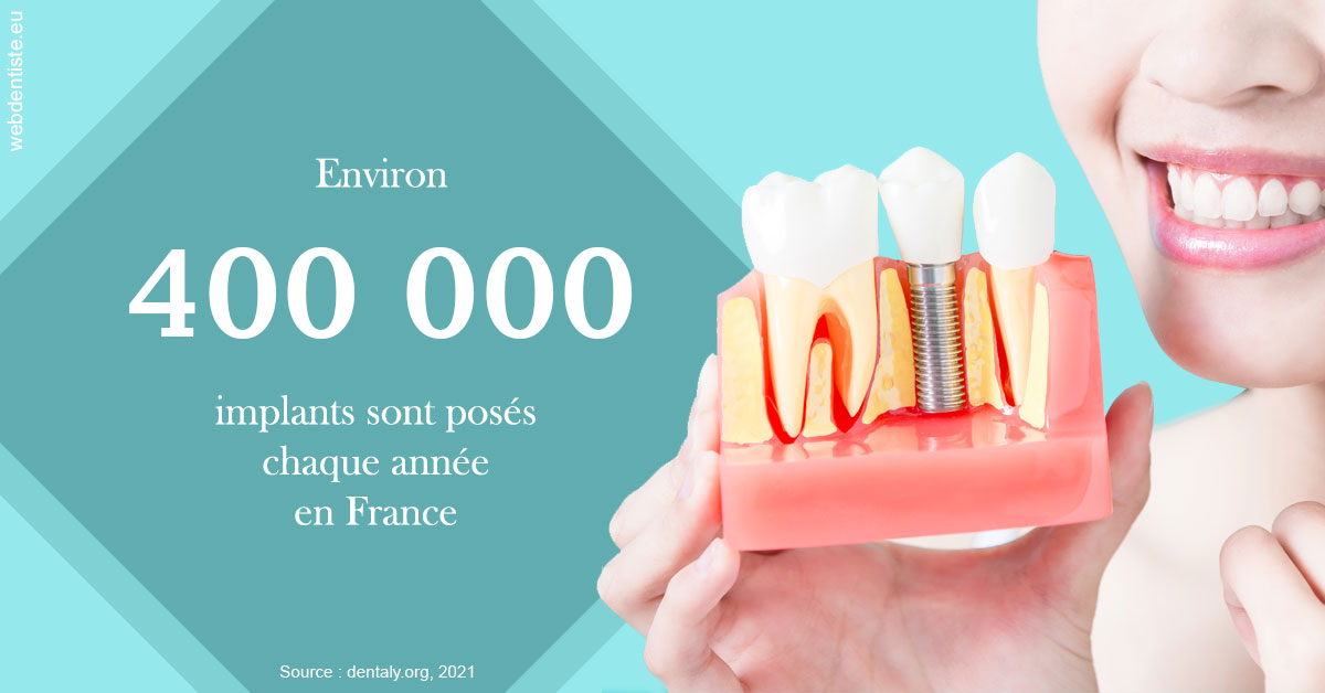 https://dr-andre-boquet-corinne-marie.chirurgiens-dentistes.fr/Pose d'implants en France 2